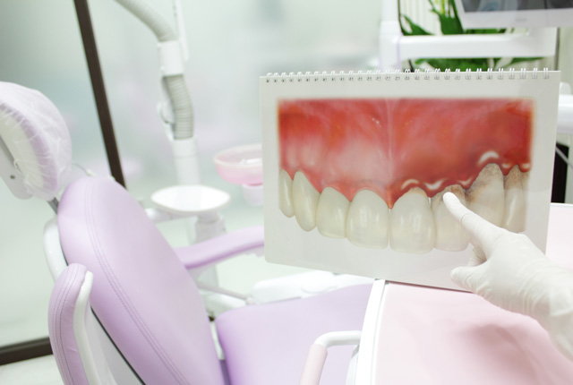 歯周組織再生治療